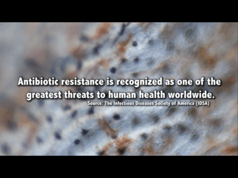 [:es]¿Antibióticos que te hacen daño?[:en]Antibiotics that harm you?[:]